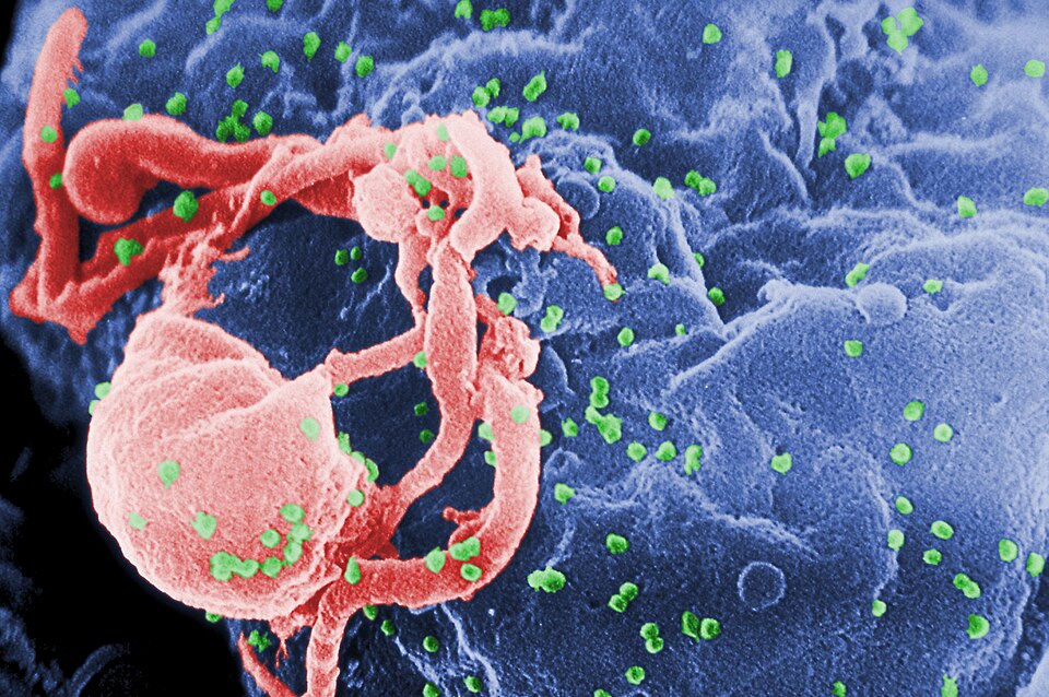 Scanning electron micrograph of HIV-1 budding (in green) from cultured lymphocyte. This image has been colored to highlight important features; see PHIL…